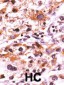 Phospho-FGFR(Y766) Antibody